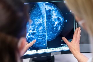 Affidea est présent en Suisse depuis 2007 avec un réseau de 15 centres de soins dans l'imagerie médicale, le diagnostic, la gastro-entérologie, ainsi que le traitement du cancer du sein. (archives) KEYSTONE/DPA/HANNIBAL HANSCHKE